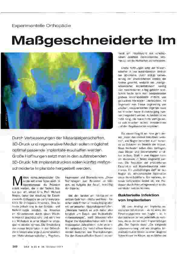 Vorschauseite 1: Maßgeschneiderte Implantate