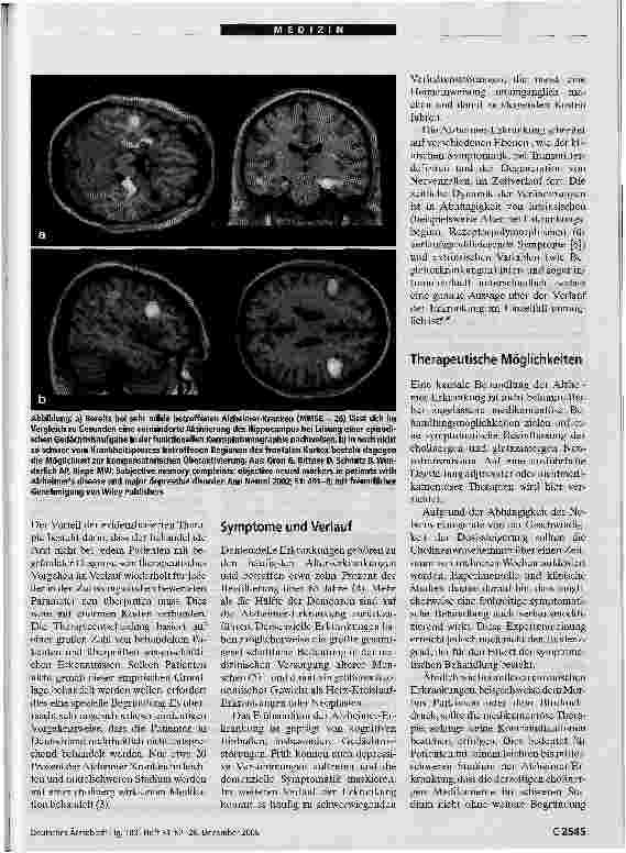 Vorschauseite 3: EvidenzbasierteTherapie der Alzheimer-Erkrankung