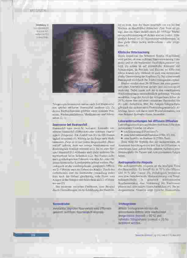 Vorschauseite 2: Diagnostik und Therapie von Haarund Kopfhauterkrankungen