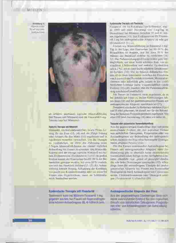 Vorschauseite 4: Diagnostik und Therapie von Haarund Kopfhauterkrankungen