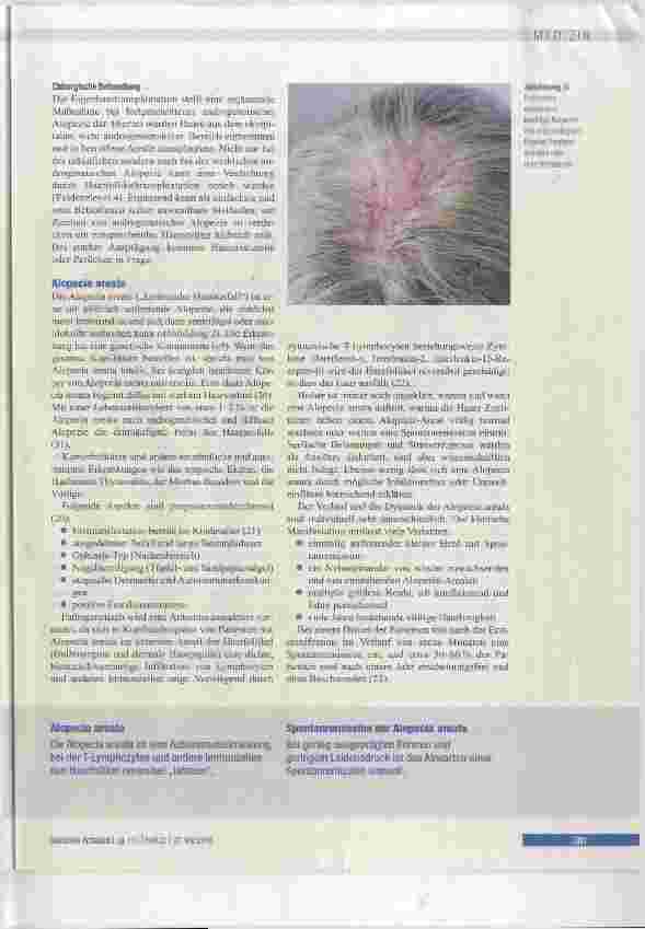Vorschauseite 5: Diagnostik und Therapie von Haarund Kopfhauterkrankungen