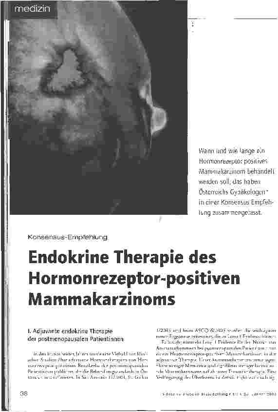 Vorschauseite 1: Konsensus-Empfehlung: Endokrine Therapie des Hormon rezeptor-positiven Mammakarzinoms