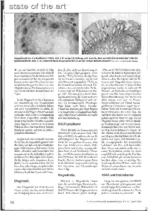 Vorschauseite 4: Helicobacter pylori