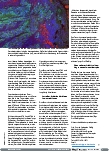 Vorschauseite 2: Neue Angriffspunkte für die Immuntherapie bei Darmkrebs identifiziert