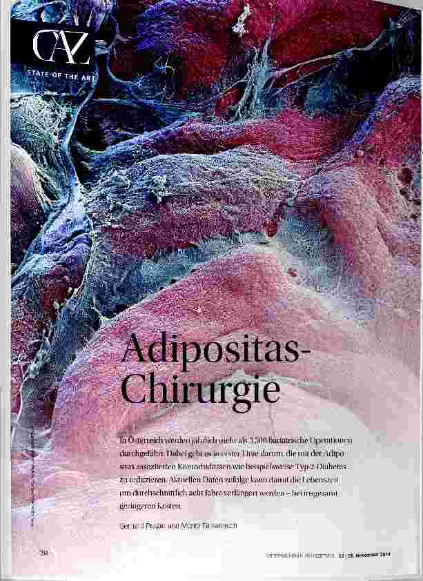 Vorschauseite 1: Adipositas-Chirurgie