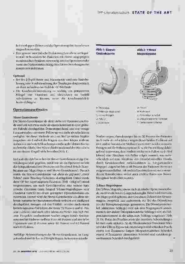 Vorschauseite 4: Adipositas-Chirurgie