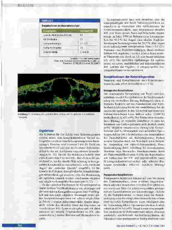 Vorschauseite 6: Kataraktchirurgie mit Implantation einer Kunstlinse