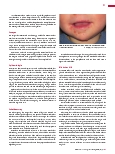 Vorschauseite 2: Hand-Fuß-Mund-Krankheit Kinderkrankheit mit saisonalem Auftreten