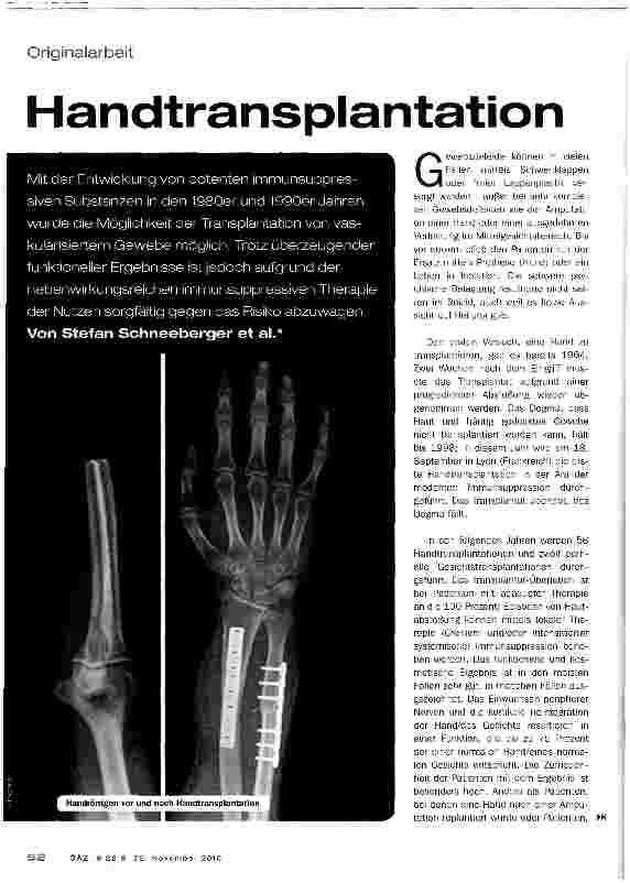 Vorschauseite 1: Handtransplantation