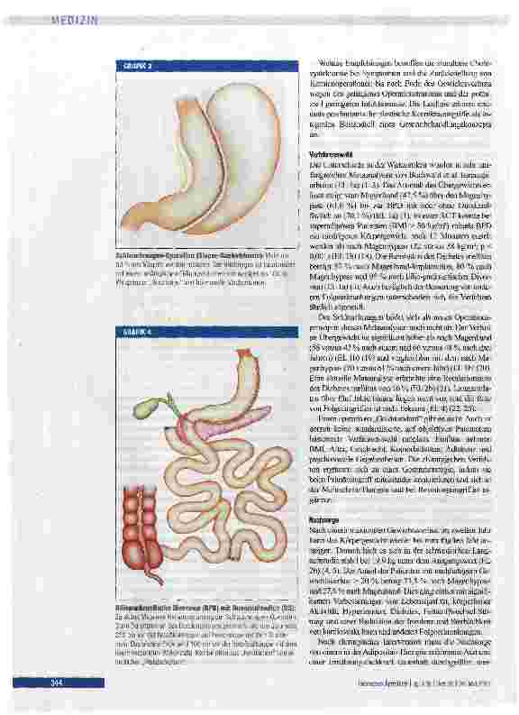 Vorschauseite 4: Chirurgie der Adipositas