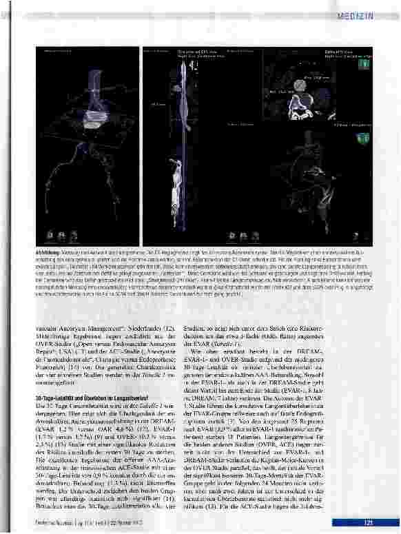 Vorschauseite 3: Stellenwert der endovaskulären Versorgung abdominaler Aortenaneurysmen