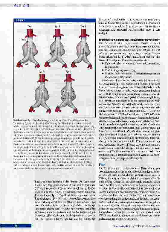 Vorschauseite 6: Stellenwert der endovaskulären Versorgung abdominaler Aortenaneurysmen