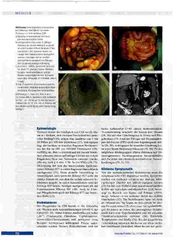 Vorschauseite 2: Clostridium-difficile-Infektion