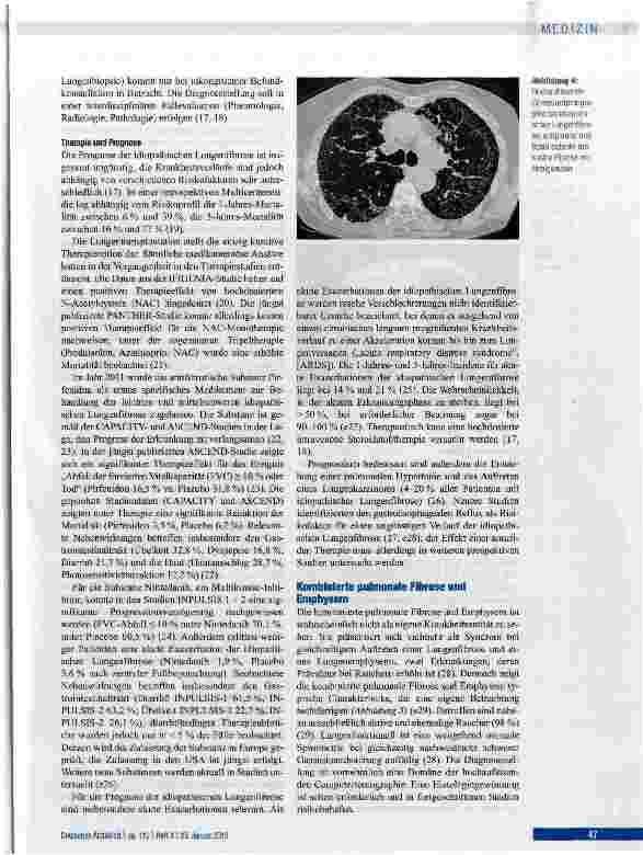 Vorschauseite 5: Tabakrauch-assoziierte interstitielle Lungenerkrankungen