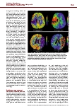 Vorschauseite 4: Intensivtherapie des ischämischen Schlaganfalls