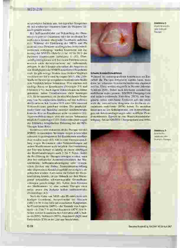 Vorschauseite 4: Hautveränderungen bei der medikamentösen HIV-Therapie