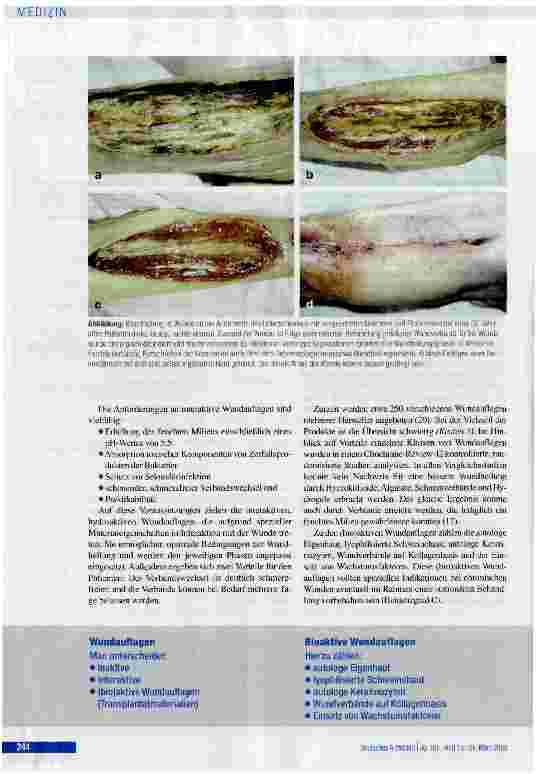 Vorschauseite 6: Wunden - von der Physiologie zum Verband