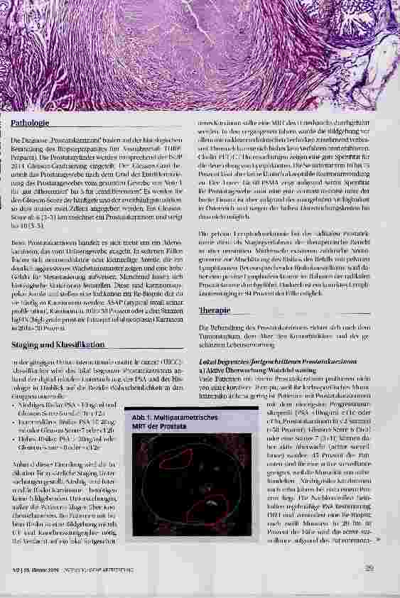 Vorschauseite 4: Prostatakarzin