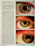 Vorschauseite 2: Bitter und süße - die Bauchspeicheldrüse als polares Organ. Ihre Darstellung im Auge - Teil 2.
