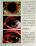 Vorschauseite 3: Bitter und süße - die Bauchspeicheldrüse als polares Organ. Ihre Darstellung im Auge - Teil 2.