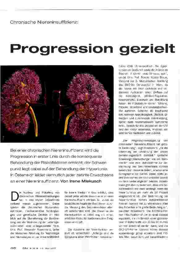 Vorschauseite 1: Progression gezielt verzögern