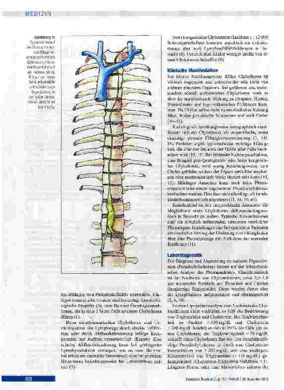 Vorschauseite 2: Therapieoptionen beim Chylothorax