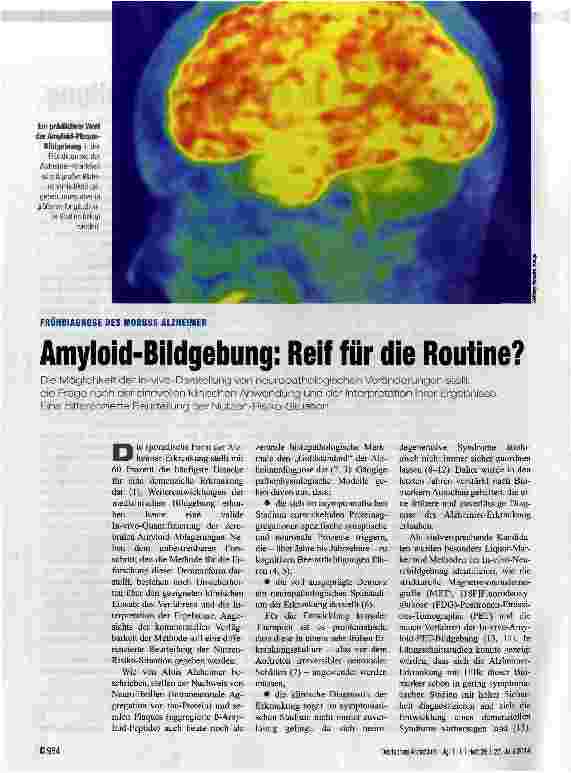 Vorschauseite 1: Amyloid-Bildgebung: Reif für die Routine?