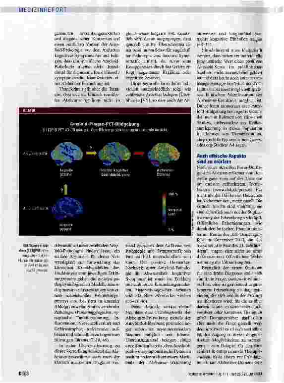 Vorschauseite 3: Amyloid-Bildgebung: Reif für die Routine?