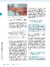 Vorschauseite 2: Die Behandlung nach Beugesehnennaht der Langfinger in der Zone II: ein Update nach 15 Jahren
