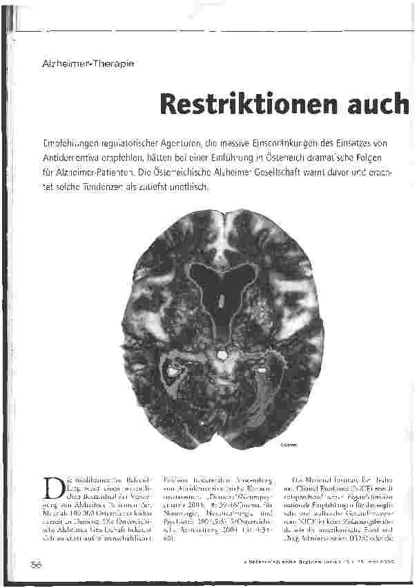 Vorschauseite 1: Alzheimer-Therapie - Restriktionen auch in Österreich?