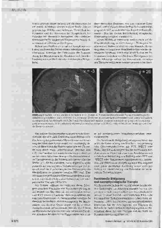 Vorschauseite 4: Perspektiven der funktioneilen Bildgebung in der Psychiatrie