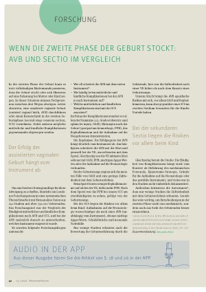 Vorschauseite 1: Wenn die zweite Phase der geburt stockt: AVB und Sectio im Vergleich