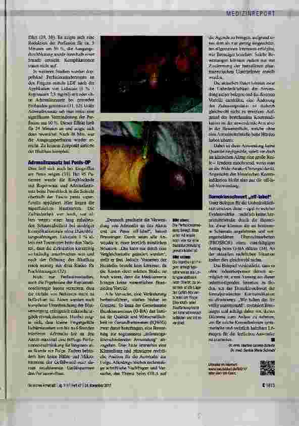 Vorschauseite 3: Adrenalin für Akren, Nase, Ohr und Penis