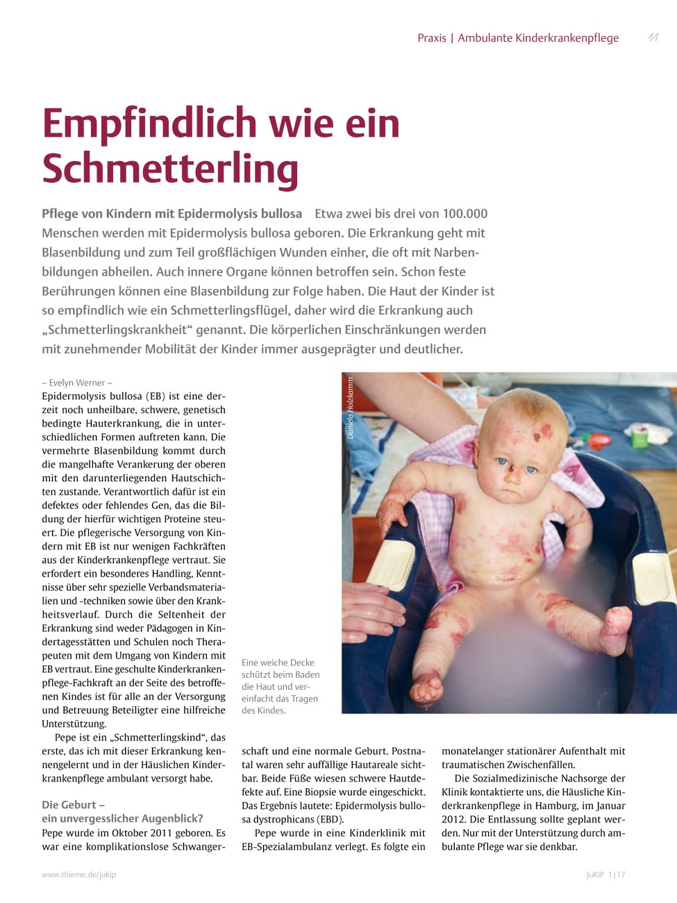 Vorschauseite 1: Empfindlich wie ein Schmetterling