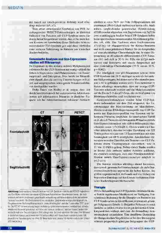 Vorschauseite 4: Metastasen ohne PrimärtumorFortschritte in Diagnostik und Therapie des CUP-Syndroms