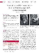 Vorschauseite 1: Anomalien und Normvarianten - Interne Veränderungen 2.17: Colon elongatum