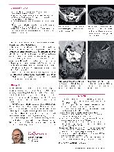 Vorschauseite 2: Anomalien und Normvarianten - Interne Veränderungen 2.17: Colon elongatum