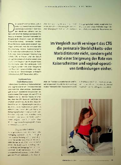 Vorschauseite 2: Intermittierende Auskultation während der Geburt.
