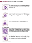Vorschauseite 3: Dysplastische Veränderungen der Hämatopoese (Teil 2) Dysgranulopoese