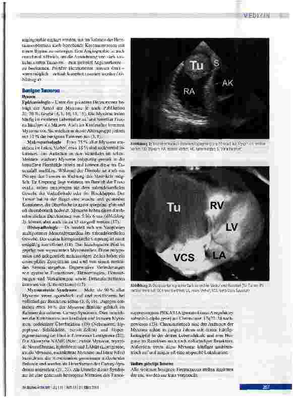 Vorschauseite 3: Herztumoren - Diagnostik und chirurgische Therapie