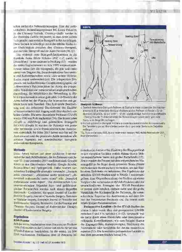 Vorschauseite 2: Fenestrierte und gebrauchte Aortenstentgrafts
