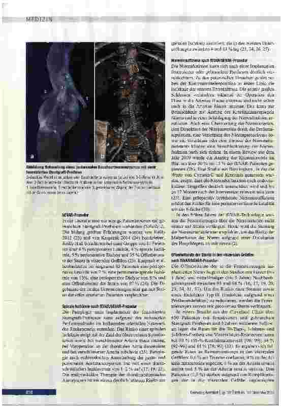 Vorschauseite 3: Fenestrierte und gebrauchte Aortenstentgrafts