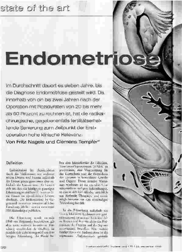 Vorschauseite 1: Endometriose