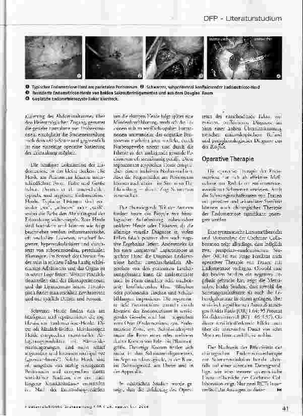 Vorschauseite 5: Endometriose