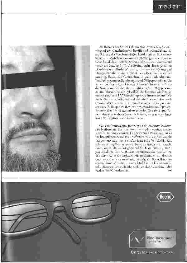 Vorschauseite 2: Rosazea - Fehldiagnose Akne