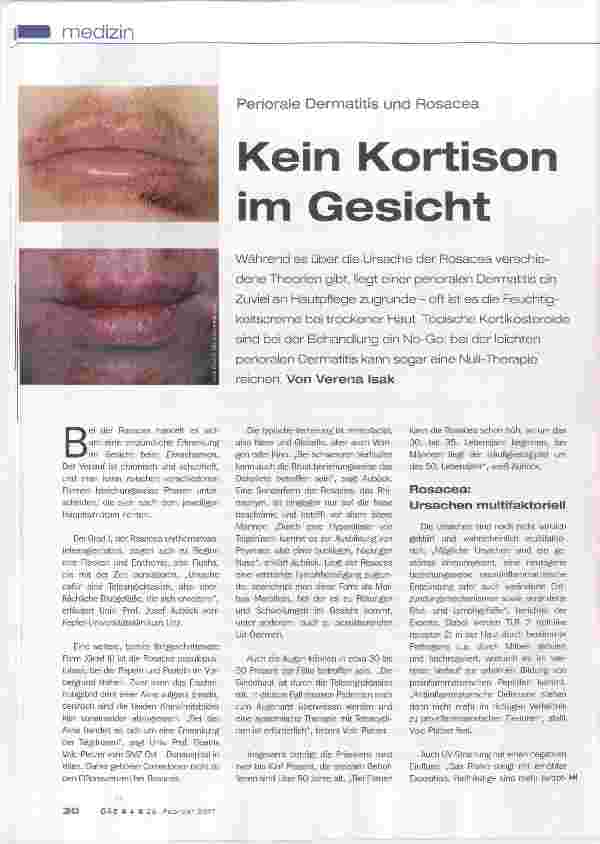 Vorschauseite 1: Kein Kortison im Gesicht