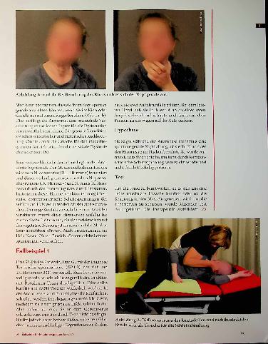 Vorschauseite 2: Den Kopf im Griff Therapie und Interventionen bei spastischem Torticollis