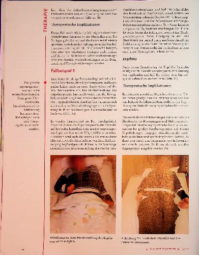 Vorschauseite 5: Den Kopf im Griff Therapie und Interventionen bei spastischem Torticollis