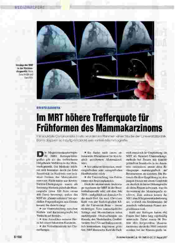 Vorschauseite 1: Im MRT höhere Trefferquote für Frühformen des Mammakarzinoms