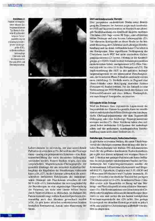 Vorschauseite 5: Therapiekonzepte und Ergebnisse bei Klatskin-Tumoren